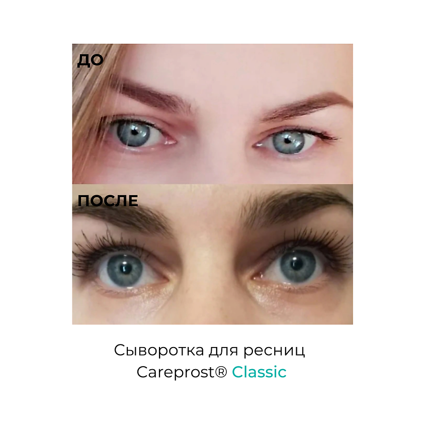 Carelash Средство Для Роста Ресниц Купить