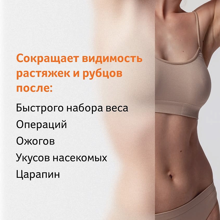 BIO-OIL Масло косметическое от шрамов, растяжек, неровного тона кожи Oil Against Scars and Stretch Marks, фото 10