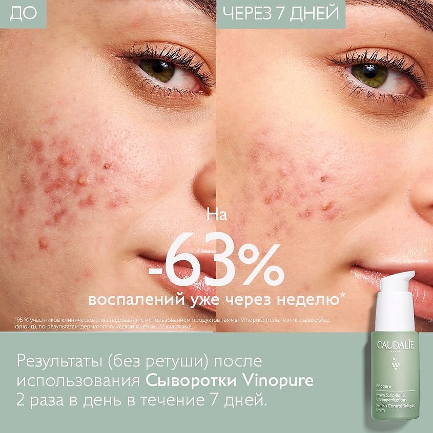 фото Caudalie сыворотка для для лица для проблемной кожи с салициловой кислотой vinopure