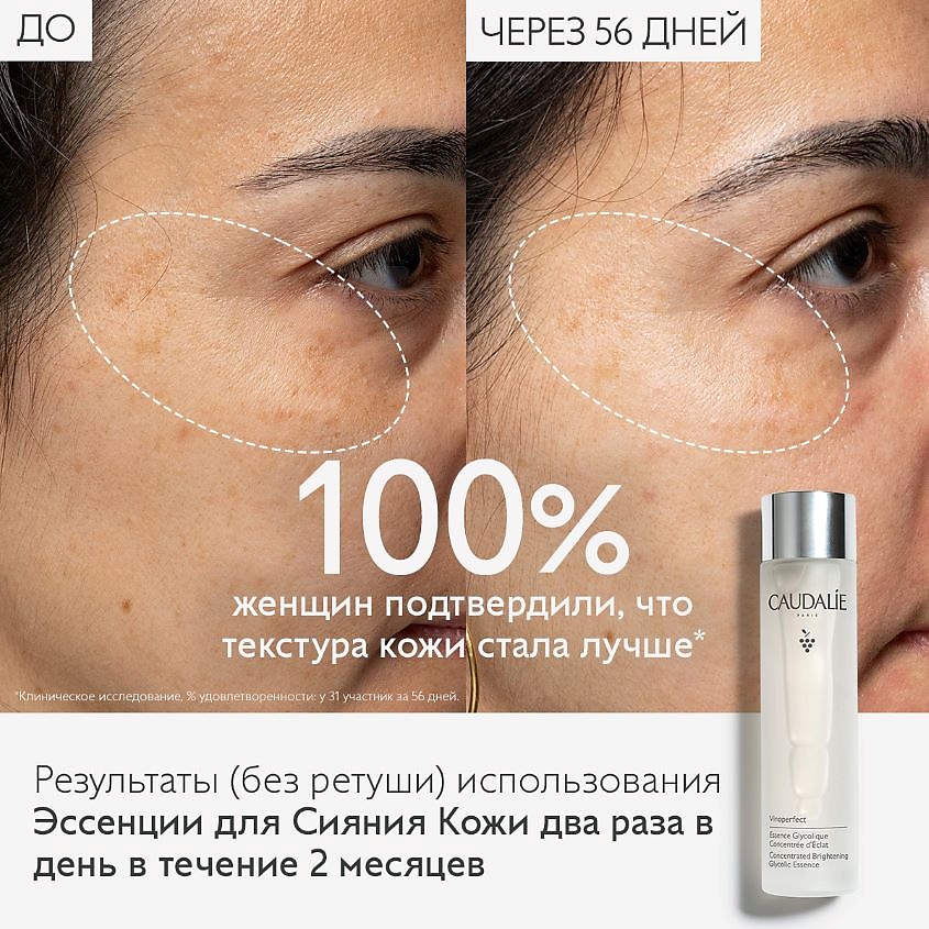 фото Caudalie эссенция для лица концентрированная для сияния кожи с гликолевой кислотой vinoperfect