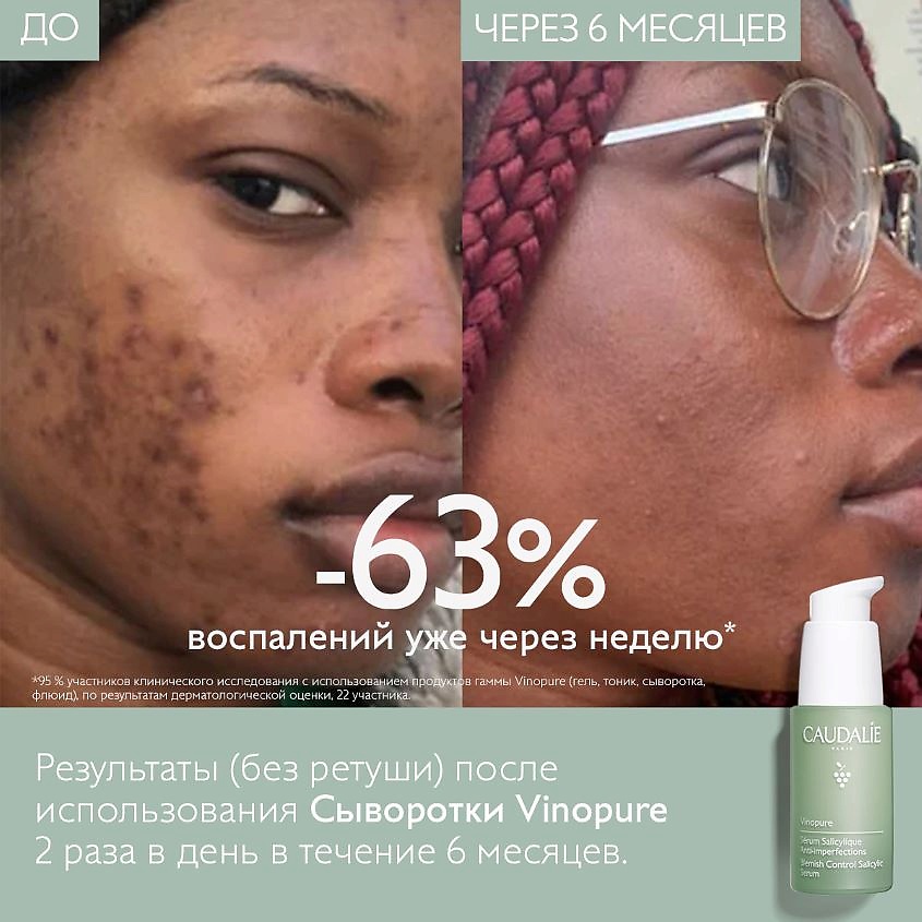 фото Caudalie сыворотка для для лица для проблемной кожи с салициловой кислотой vinopure