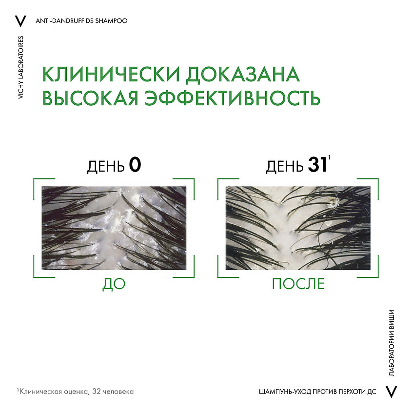 

VICHY Dercos Интенсивный шампунь против перхоти, зуда и себореи для нормальных и жирных волос с селеном и салициловой кислотой, восстанавливающий уход для волос, Dercos Интенсивный шампунь против перхоти, зуда и себореи для нормальных и жирных волос с сел