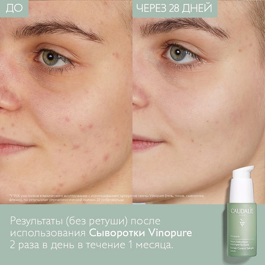 фото Caudalie сыворотка для для лица для проблемной кожи с салициловой кислотой vinopure