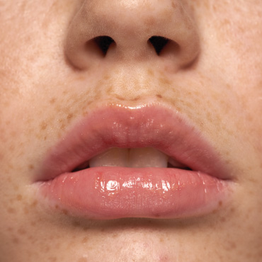 Топ 5 способов увеличить губы